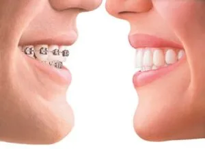 La Importancia Del Tratamiento de Ortodoncia